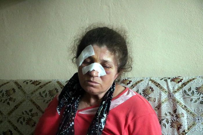Bolu'da Akrabalar Arasında Baltalı Kavga